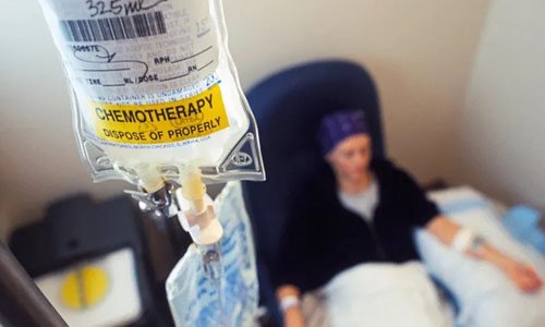 Chemotherapy for Ovary Cancer